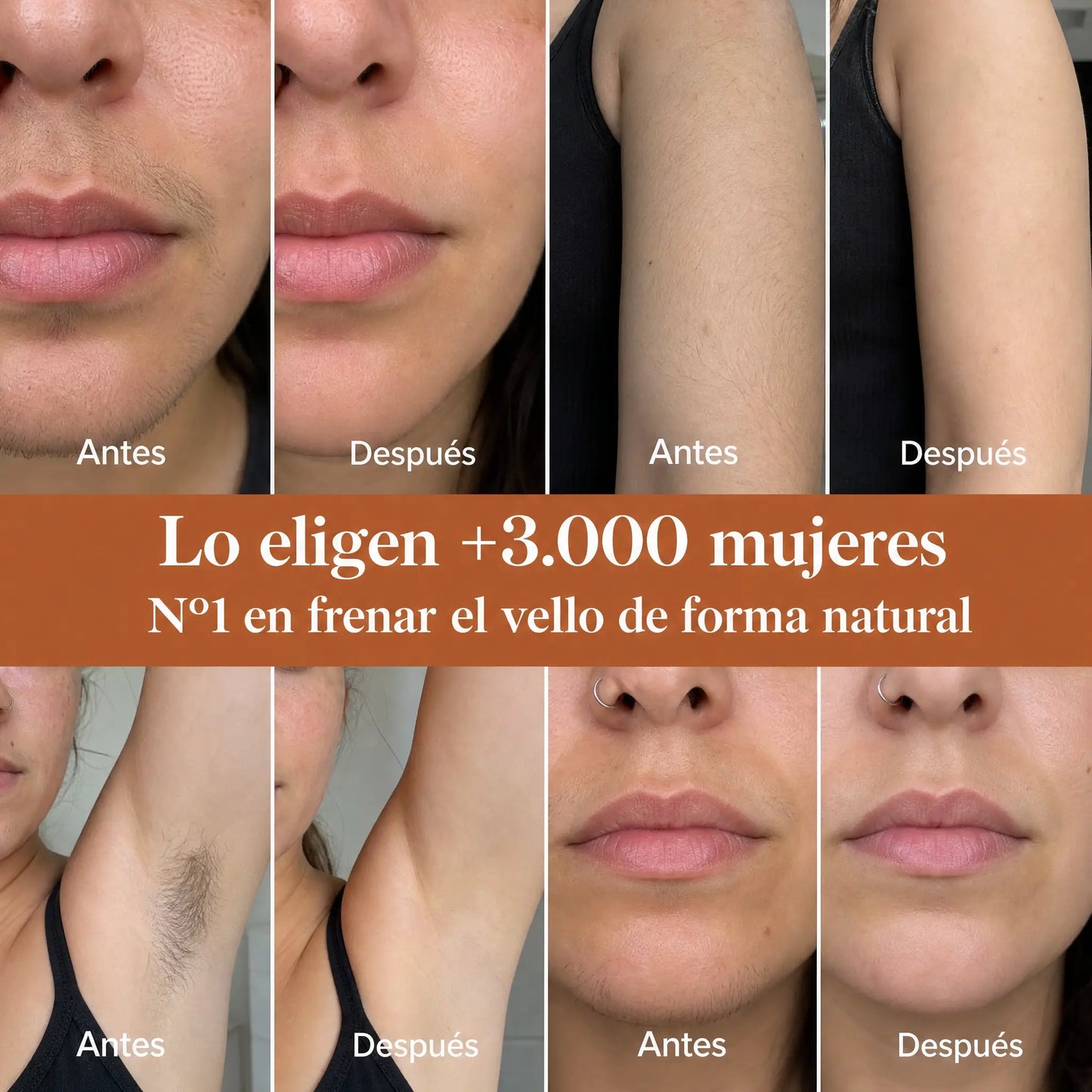 VitalBioLabs™ Aceite Reductor de Vello No Deseado